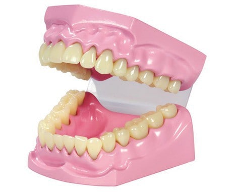 Dental model