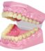 Dental model